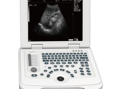 Digital Portable Ultrasound Machine Human B Ultrasonic Scanner CE ISO 5 probespicture1