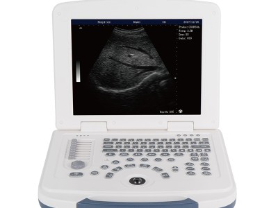 Digital Portable Ultrasound Machine Human B Ultrasonic Scanner CE ISO 5 probespicture2